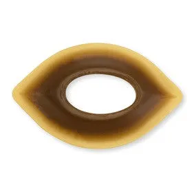 Adapt Convex Barrier Rings