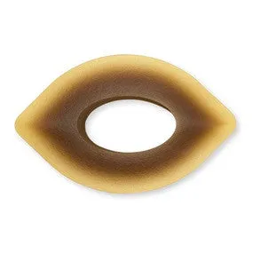 Adapt Convex Barrier Rings